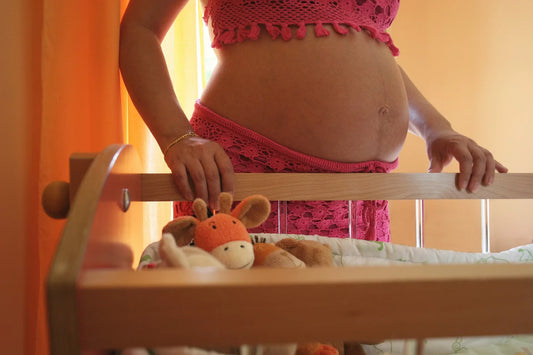 How To Prevent and Lighten Stretch Marks